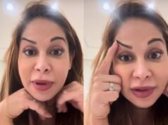 Maíra Cardi exibe rosto deformado após botox dar errado: ‘Olha que piada’